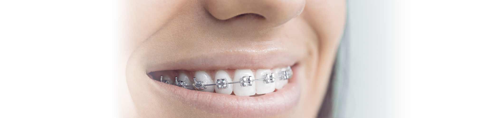 Orthodontics Newport Pagnell