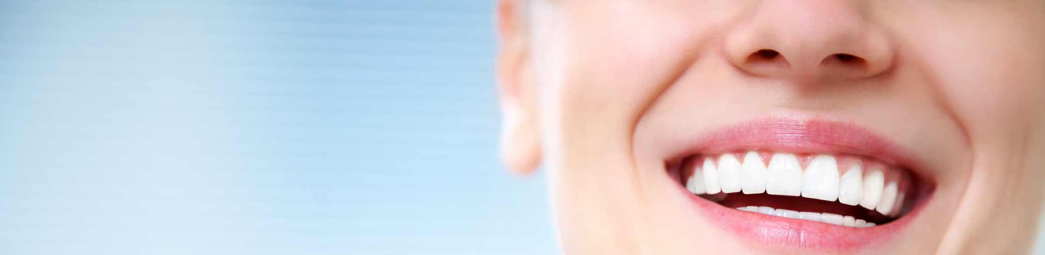 Veneers Newport Pagnell